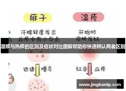 湿疹与热疹的区别及症状对比图解帮助你快速辨认两者区别